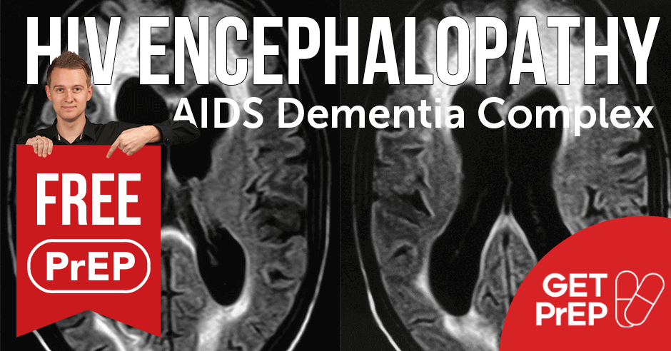 HIV encephalopathy (AIDS Dementia Complex)