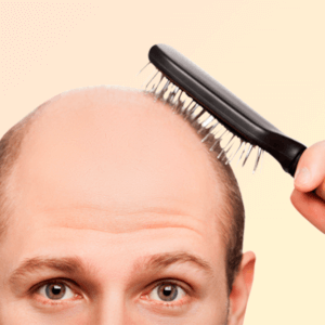 Hair loss